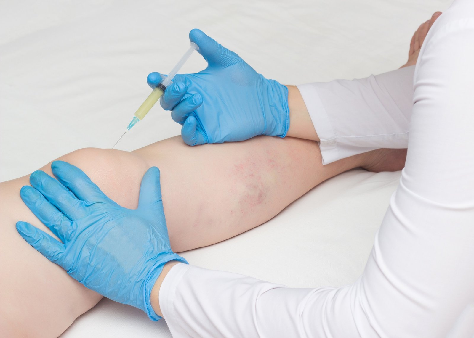 Ozone therapy treatment